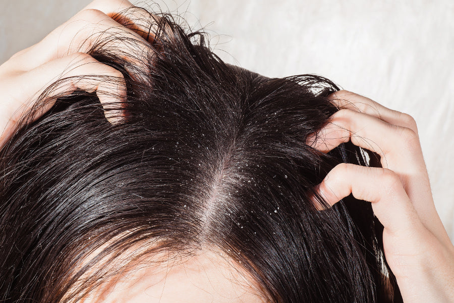 A Healthy Scalp Leads To Healthy Hair!