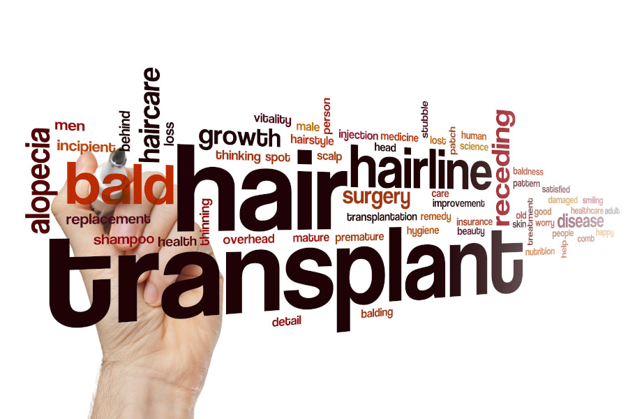 Hair Transplants: What you need to know