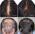 Male and Female Hair Loss