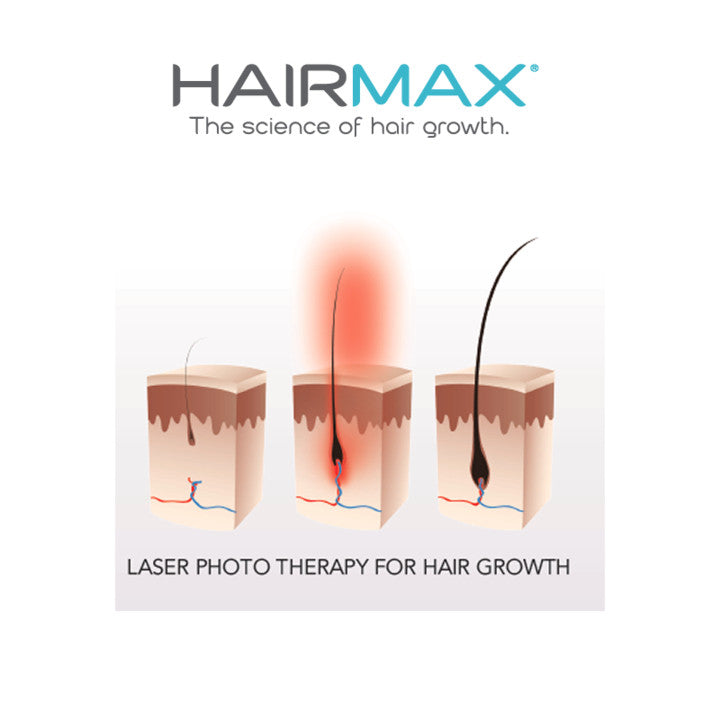 Effects of Low Level Laser Therapy (LLLT) on the Hair Follicle and Hair Falling Out