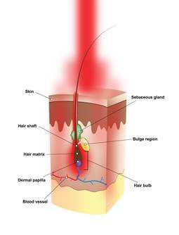 Early Beginnings of Hair Growth Laser Laser Light Therapy