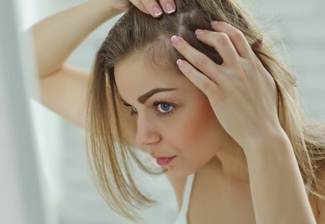 Hair Loss In Women